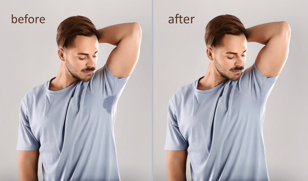 Clothing for Hyperhidrosis: 8 Tips to Dress Without Sweating (or Worrying)