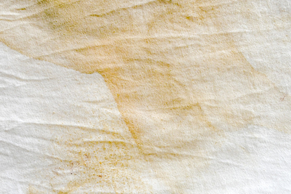 How to Remove Yellow Stains from White Clothes?